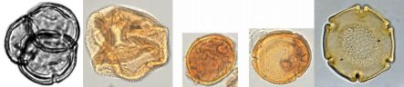 A selection of pollen grains